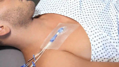 Curafix i.v. Film Katheterfixierpflaster aus transparenter Folie - steril Lohmann & Rauscher