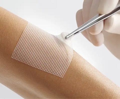 Lomatuell Pro gelbildendes Kontaktnetz Lohmann & Rauscher