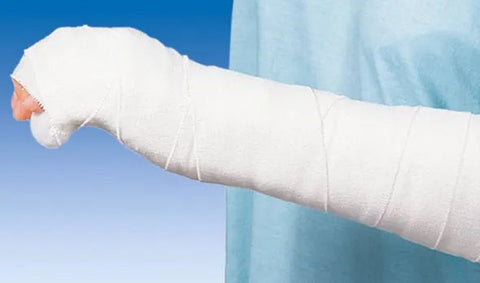 Idealast Binde 15cmx5m cel (P1) Hartmann