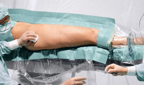 Foliodrape Vertical Isolation Set III,PE Hartmann