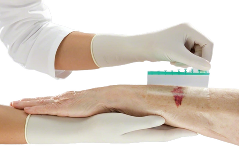 Askina® Derm transparenter Wundverband 6 cm x 7 cm B. Braun