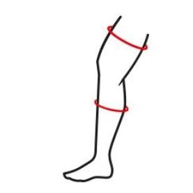 Cellacare Genucast 20° Classic Knieschiene Lohmann & Rauscher