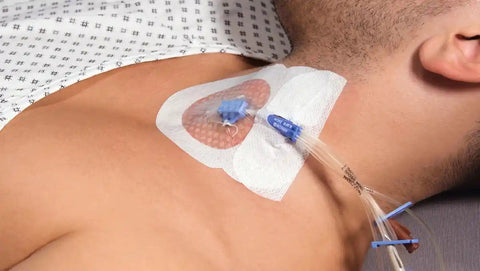 Curafix i.v. Control Katheterfixierung 9x11cm, 50 Stück, steril Lohmann & Rauscher