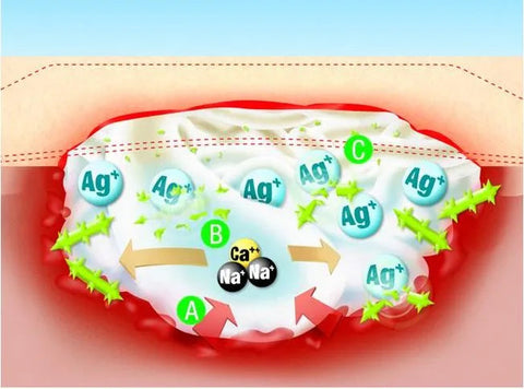 Suprasorb A+Ag Kompresse Lohmann & Rauscher