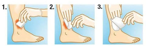 Suprasorb A+Ag Kompresse Lohmann & Rauscher