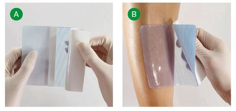 Suprasorb® G Gel-Kompresse Lohmann & Rauscher