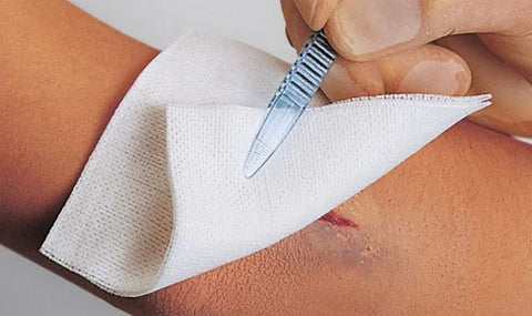 Vliwasoft Stoma Vliesstoffkompresse 10x10cm, 4-fach - 100 Stück im Papierbeutel Lohmann & Rauscher