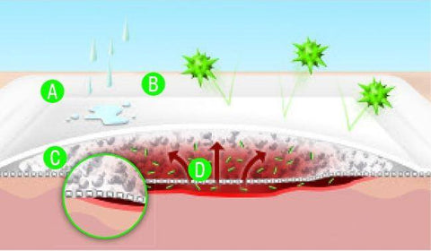 Vliwasorb adhesive Wundverband - Der selbstklebende Superabsorber-Wundverband